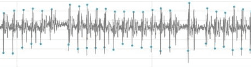Postextrasystolic potentiation