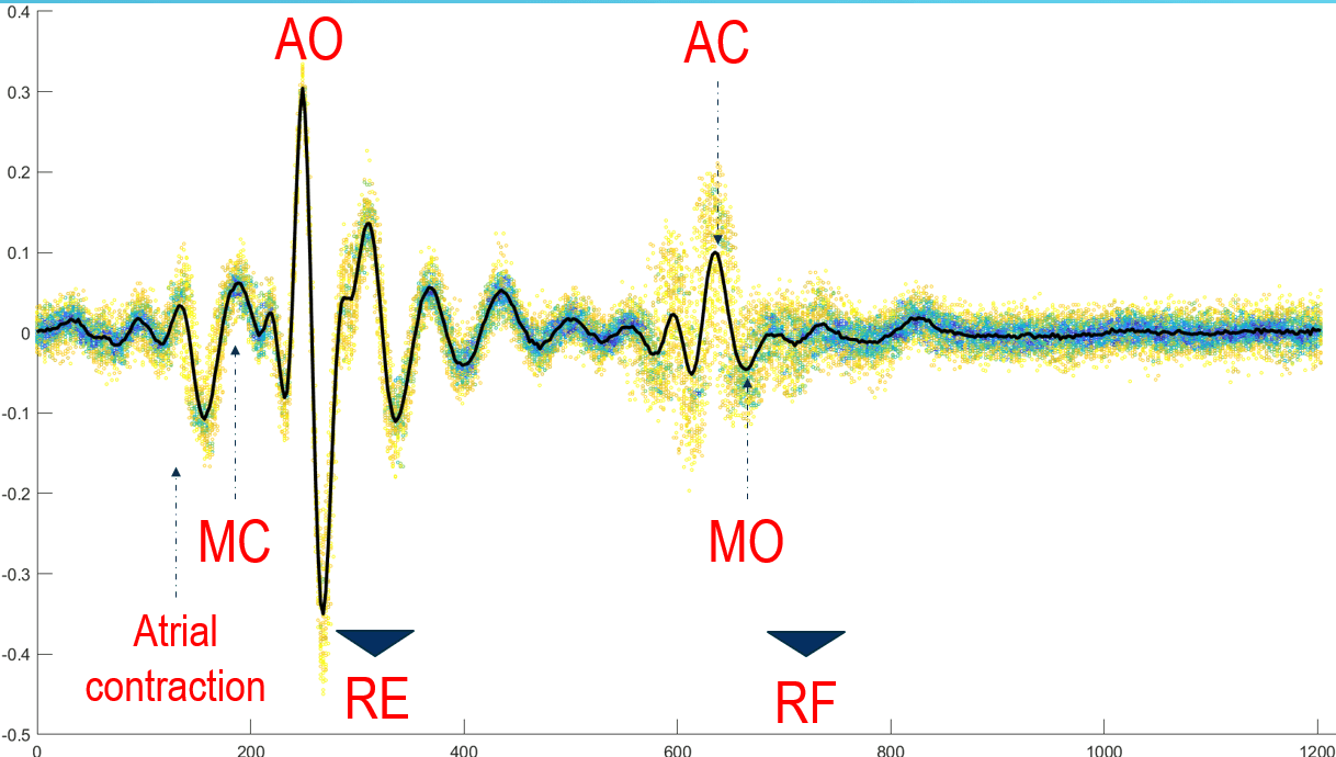 Cardiac cycle graph