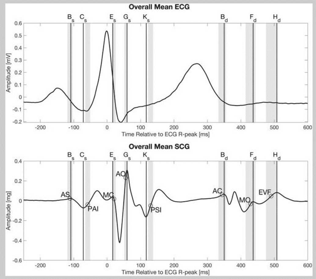 SCG vs ECG