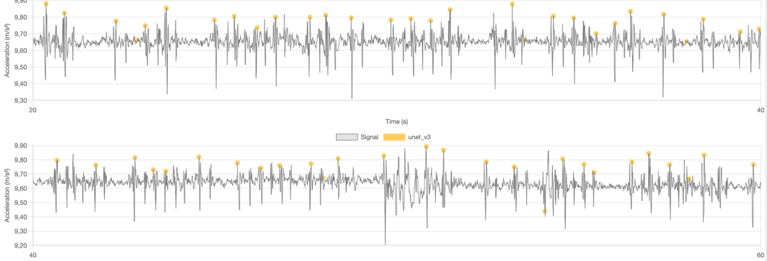 Atrial fibrillation