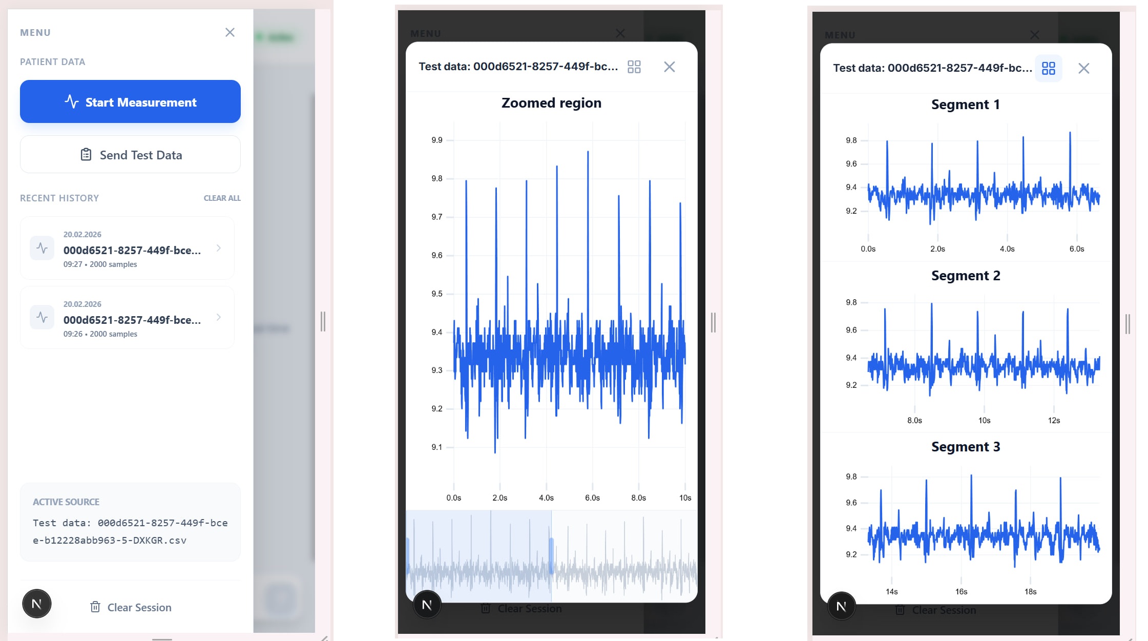 CardioAI Interface Preview